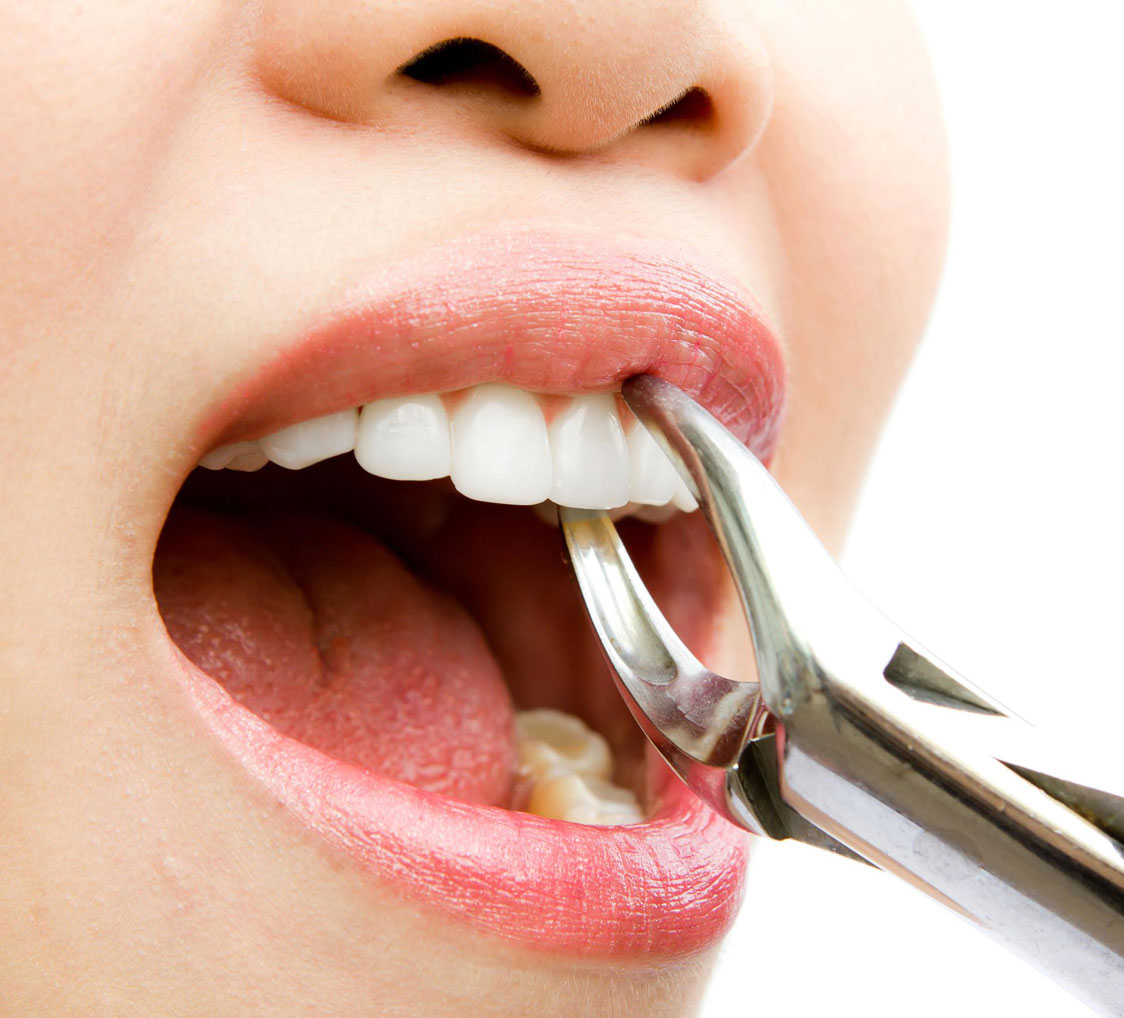 جراحی و کشیدن دندان