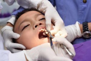 کشیدن‌ دندان کودکان